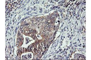 Image no. 4 for anti-Tubby Like Protein 3 (TULP3) antibody (ABIN1501583)