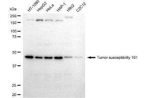 Western blotting analysis using tumor susceptibility 101 antibody (ABIN7800696).