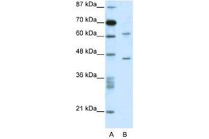 C1ORF25 antibody used at 0. (TRMT1L 抗体  (N-Term))