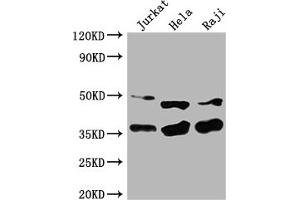 Western Blot Positive WB detected in: Jurkat whole cell lysate, Hela whole cell lysate, Raji whole cell lysate All lanes: NFKBIA antibody at 1:2000 Secondary Goat polyclonal to rabbit IgG at 1/50000 dilution Predicted band size: 36 kDa Observed band size: 36 kDa (NFKBIA 抗体  (AA 27-317))