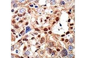 Immunohistochemistry (IHC) image for anti-Promyelocytic Leukemia (PML) (AA 470-499), (Sumoylation Site) antibody (ABIN3032330)