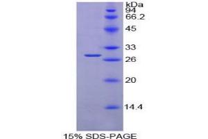 SDS-PAGE analysis of Mouse PDIA2 Protein. (PDIA2 蛋白)