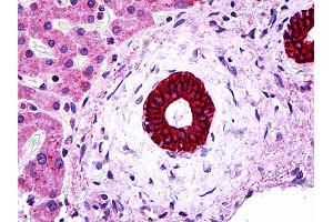 IHC Information: Paraffin embedded bileduct tissue, tested with an antibody dilution of 5 ug/ml. (Cytokeratin 19 抗体  (N-Term))