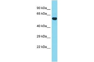 Host: Rabbit Target Name: CCDC149 Sample Type: Fetal Heart lysates Antibody Dilution: 1. (CCDC149 抗体  (N-Term))