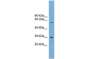 WB Suggested Anti-RPAIN  Antibody Titration: 0. (RPAIN 抗体  (C-Term))