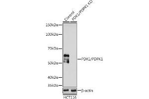 Western Blotting (WB) image for anti-3-phosphoinositide Dependent Protein Kinase-1 (PDPK1) (AA 150-429) antibody (ABIN3022352)