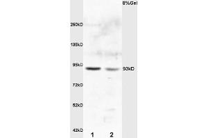 L1 rat kideny lysates L2 rat brain lysates probed with Anti E2F8 Polyclonal Antibody, Unconjugated (ABIN706106) at 1:200 overnight at 4 °C. (E2F8 抗体)