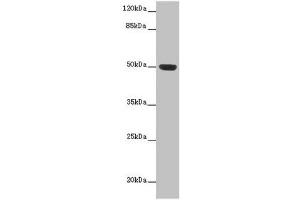 Western blot All lanes: HTR3D antibody at 2 μg/mL + Hela whole cell lysate Secondary Goat polyclonal to rabbit IgG at 1/10000 dilution Predicted band size: 51, 31, 26, 46 kDa Observed band size: 51 kDa (HTR3D 抗体  (AA 107-210))