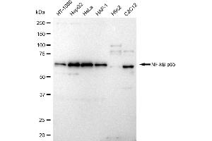 Western blotting analysis using NF-kB p65 antibody (ABIN7799645). (Recombinant NF-kB p65 抗体)