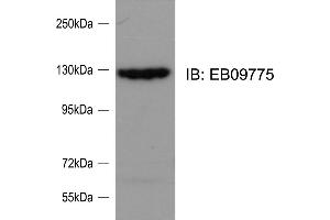 ABIN571090 (0. (SRGAP2 抗体  (Internal Region))