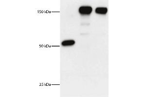 Lane 1 - DEC Monoclonal AntibodyLane 2 - DEC-HER2 Monoclonal AntibodyLane 3 - Control Ig-HER2 Monoclonal AntibodyHER2 extracellular domain was cloned in frame into the COOH terminus of anti-DEC (DEC-HER2). (山羊 anti-小鼠 IgG1 (Heavy Chain) Antibody (HRP))