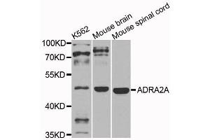 Western blot analysis of extracts of various cells, using ADRA2A antibody. (ADRA2A 抗体)