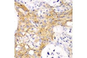 Immunohistochemistry (Paraffin-embedded Sections) (IHC (p)) image for anti-Actin, alpha 2, Smooth Muscle, Aorta (ACTA2) (AA 1-124) antibody (ABIN6136473)