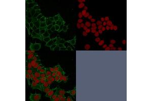Confocal immunofluorescence image of HeLa cells using Catenin, gamma Mouse Monoclonal Antibody (11E4) Green (CF488) and Reddot is used to label the nuclei Red. (JUP 抗体)