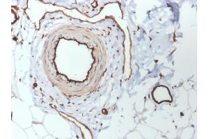 Formalin-fixed, paraffin-embedded human skin stained with CD31 Mouse Monoclonal Antibody (PECAM1/3530). (CD31 抗体  (AA 625-738))