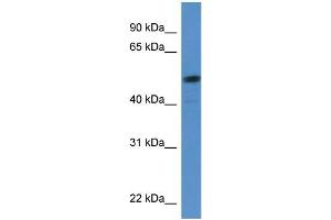 Human HeLa; WB Suggested Anti-SOX5 Antibody Titration: 0. (SOX5 抗体  (C-Term))
