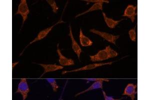 Immunofluorescence analysis of L929 cells using RPE Polyclonal Antibody at dilution of 1:100 (40x lens).