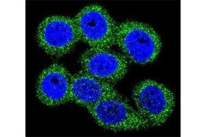 Confocal immunofluorescent analysis of ABCG1 antibody with 293 cells followed by Alexa Fluor 488-conjugated goat anti-rabbit lgG (green).