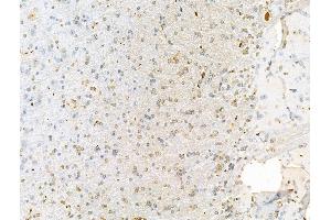 ABIN7094557 and ABIN7098606 at 1/100 staining Rat brain tissue by IHC-P.