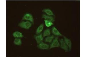 Methanol-fixed Hela cells stained with 10mg/mL anti-Human CRP mAb S5G1 and fluorescence labelled secondary antibody. (CRP 抗体)