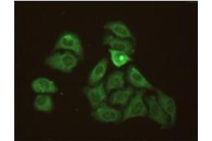Methanol-fixed Hela cells stained with 10mg/mL anti-Human CRP mAb S5G1 and fluorescence labelled secondary antibody.