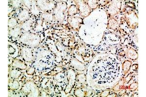 Immunohistochemical analysis of paraffin-embedded human-kidney, antibody was diluted at 1:200 (CD16a, CD16b (AA 100-150) 抗体)