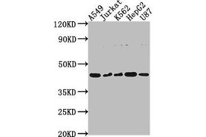 Western Blot Positive WB detected in: A549 whole cell lysate, Jurkat whole cell lysate, K562 whole cell lysate, HepG2 whole cell lysate, U87 whole cell lysate All lanes: DNASE2B antibody at 1:2000 Secondary Goat polyclonal to rabbit IgG at 1/50000 dilution Predicted band size: 42, 18 kDa Observed band size: 42 kDa (DNASE2B 抗体  (AA 68-281))