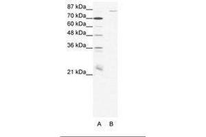 Image no. 1 for anti-Mediterranean Fever (MEFV) (N-Term) antibody (ABIN202912) (MEFV 抗体  (N-Term))