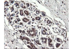 Immunohistochemical staining of paraffin-embedded Human breast tissue using anti-PNPO mouse monoclonal antibody. (PNPO 抗体)