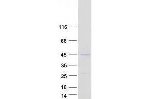 Western Blotting (WB) image for Cyclin-Dependent Kinase 14 (CDK14) protein (Myc-DYKDDDDK Tag) (ABIN2728764)
