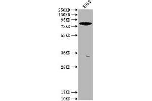 Western Blot Positive WB detected in: K562 whole cell lysate All lanes: ACSL6 antibody at 1:1000 Secondary Goat polyclonal to rabbit IgG at 1/50000 dilution Predicted band size: 78, 81, 75, 77, 80, 70 kDa Observed band size: 78 kDa (ACSL6 抗体  (AA 214-484))