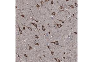 Immunohistochemical staining of human hippocampus with SLC25A38 polyclonal antibody  shows strong cytoplasmic positivity in neuronal cells at 1:50-1:200 dilution. (SLC25A38 抗体)