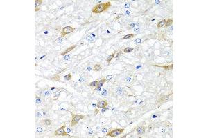 Immunohistochemistry of paraffin-embedded rat brain using CPA6 antibody at dilution of 1:100 (40x lens). (CPA6 抗体)