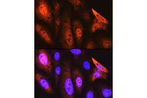 Immunofluorescence (IF) image for anti-COP9 Constitutive Photomorphogenic Homolog Subunit 5 (Arabidopsis) (COPS5) antibody (ABIN7266497)