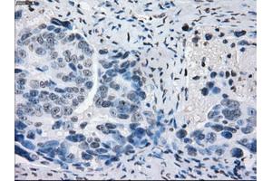 Immunohistochemical staining of paraffin-embedded colon tissue using anti-PRKYmouse monoclonal antibody. (PRKY 抗体)