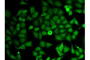 Immunofluorescence analysis of HeLa cells using IMPDH2 antibody (ABIN5973086). (IMPDH2 抗体)