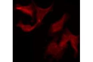ABIN6275213 staining Hela by IF/ICC. (LRP11 抗体  (Internal Region))