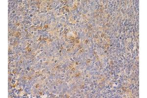 ABIN6261451 and ABIN6266860 at 1/100 staining human normal tonsil tissue by IHC-P. (Ephrin A5 抗体  (Internal Region))