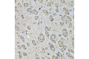 Immunohistochemistry of paraffin-embedded mouse brain using PDIA6 Antibody (ABIN5974243) at dilution of 1/100 (40x lens). (PDIA6 抗体)
