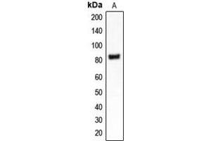 Western blot analysis of CLCN4 expression in MDAMB453 (A) whole cell lysates. (CLCN4 抗体  (Center))