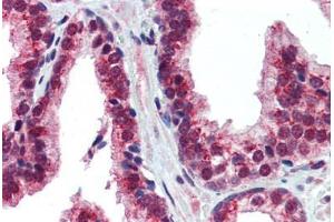 Human Prostate (formalin-fixed, paraffin-embedded) stained with NR2E1 antibody ABIN462191 followed by biotinylated goat anti-rabbit IgG secondary antibody ABIN481713, alkaline phosphatase-streptavidin and chromogen.