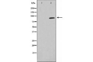 Western blot analysis on K562 cell lysate using EPN1 Antibody，The lane on the left is treated with the antigen-specific peptide. (Epsin 1 抗体)
