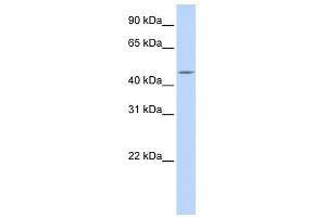 Carboxypeptidase E antibody used at 1 ug/ml to detect target protein.