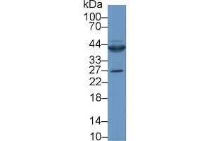 Western Blotting (WB) image for anti-Connective Tissue Growth Factor (CTGF) (AA 80-200) antibody (ABIN7437947)
