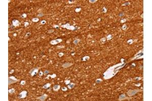 The image on the left is immunohistochemistry of paraffin-embedded Human brain tissue using ABIN7129824(IGSF8 Antibody) at dilution 1/15, on the right is treated with fusion protein. (IGSF8 抗体)