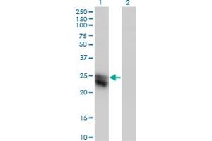 Western Blot analysis of CTHRC1 expression in transfected 293T cell line by CTHRC1 monoclonal antibody (M05), clone 1G12.
