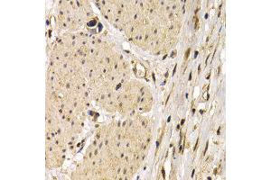 Immunohistochemistry (IHC) image for anti-CD40 (CD40) antibody (ABIN3020704) (CD40 抗体)
