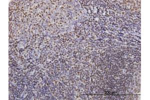 Immunoperoxidase of purified MaxPab antibody to IKZF3 on formalin-fixed paraffin-embedded human tonsil. (IKZF3 抗体  (AA 1-509))