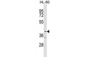 Western Blotting (WB) image for anti-Ankyrin Repeat and BTB (POZ) Domain Containing 1 (ABTB1) antibody (ABIN2999338) (ABTB1 抗体)