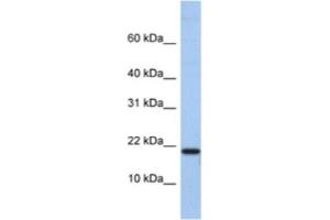 Western Blotting (WB) image for anti-C1D Nuclear Receptor Corepressor (C1D) antibody (ABIN2463344) (C1D 抗体)